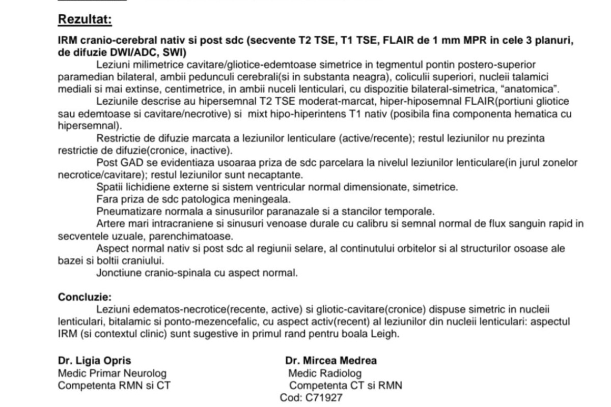 Tudor, un băiețel de 3 ani din Ploiești, luptă cu Sindromul Leigh. Familia cere ajutor din partea comunității pentru un transplant mitocondrial 5 Tudor, un băiețel de 3 ani din Ploiești, luptă cu Sindromul Leigh. Familia cere ajutor din partea comunității pentru un transplant mitocondrial 3