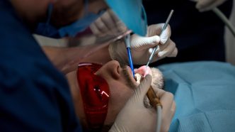 Rezultatul după 3 ani de aparat dentar cu safir. Tratamentul a pornit de la o problemă de ocluzie, nu de la estetică.